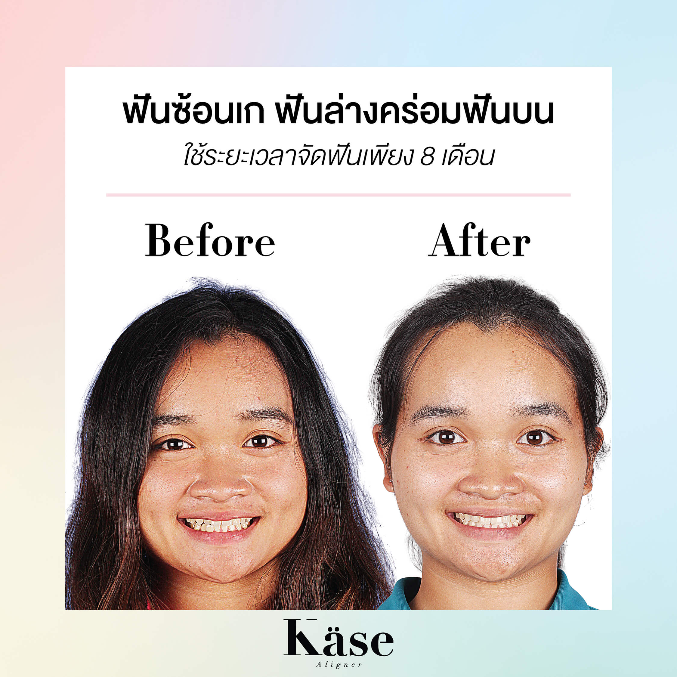 Before After Cases-01
