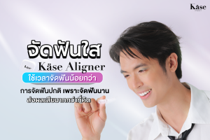 จัดฟันใส Käse Aligner