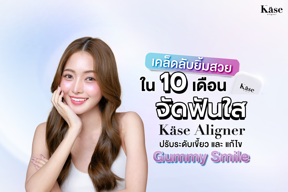 จัดฟันใส Käse Aligner