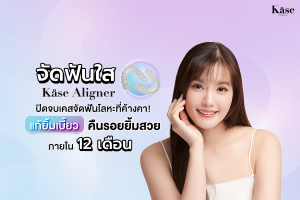 จัดฟันใส Käse Aligner