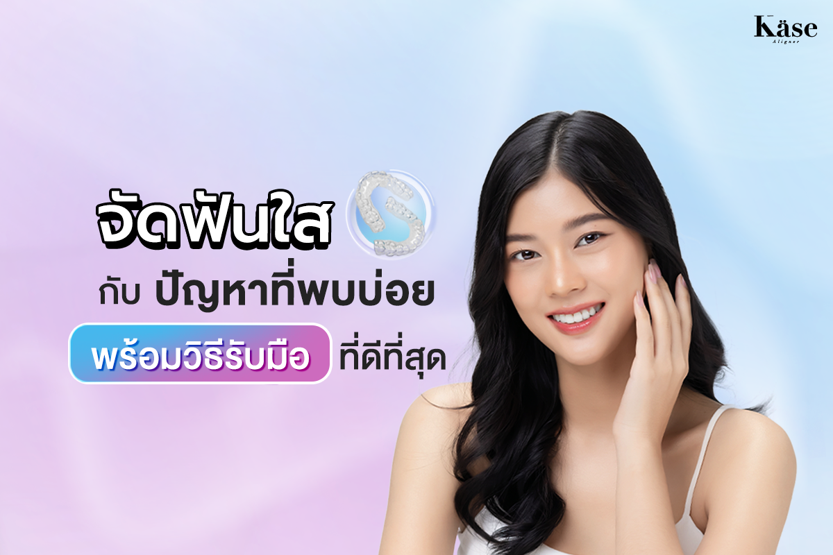 จัดฟันใส Käse Aligner