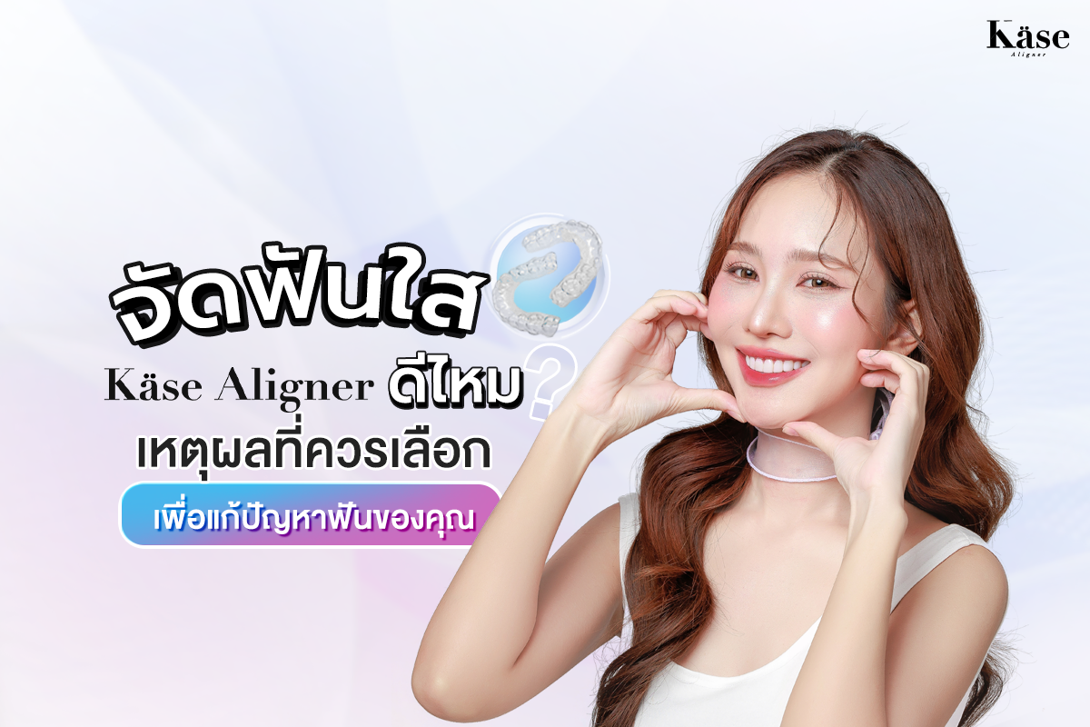 จัดฟันใส Käse Aligner