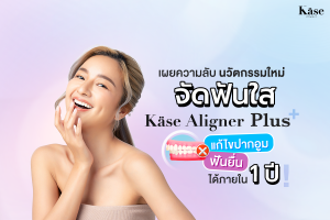 จัดฟันใส Käse Aligner PLUS
