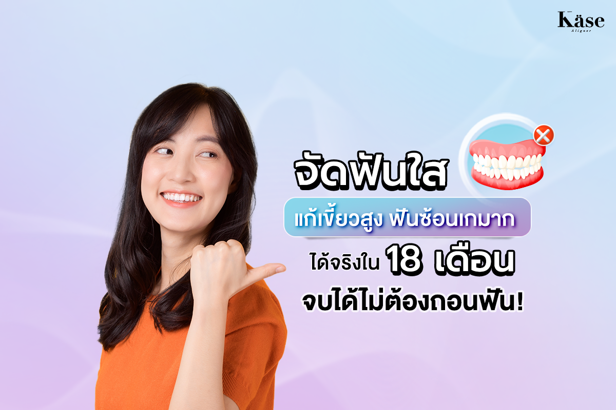 จัดฟันใส ไม่ถอนฟัน