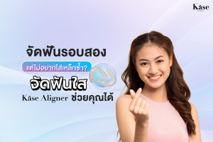 จัดฟันใส Käse Aligner