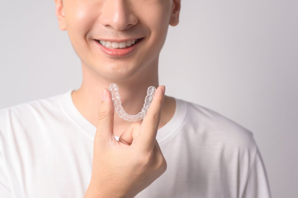 จัดฟันใส Käse Aligner