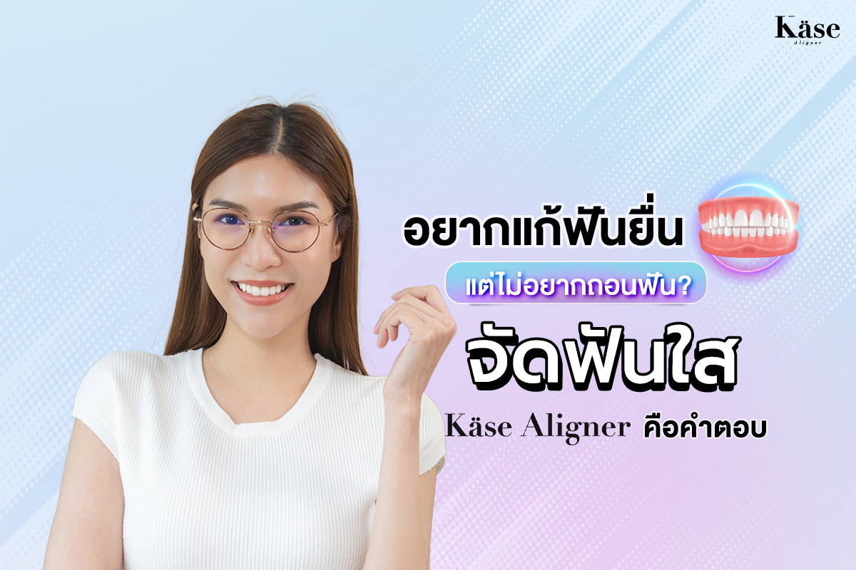 จัดฟันใส Käse Aligner