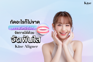 จัดฟันใส Käse Aligner