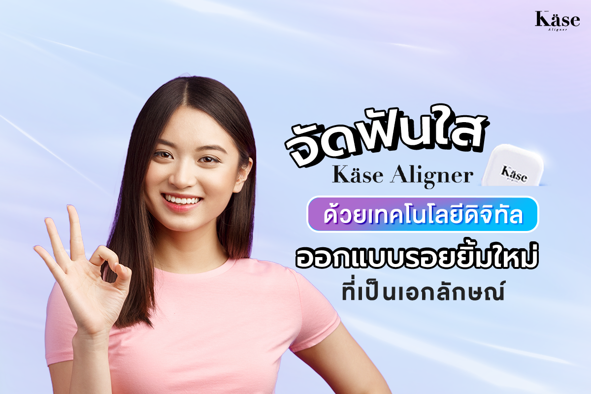 จัดฟันใส Käse Aligner