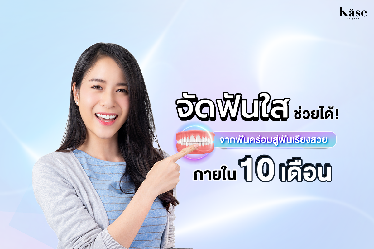 จัดฟันใส ช่วยได้! จากฟันคร่อมสู่ฟันเรียงสวยภายใน 10 เดือน