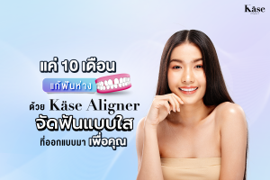 จัดฟันแบบใส Käse Aligner