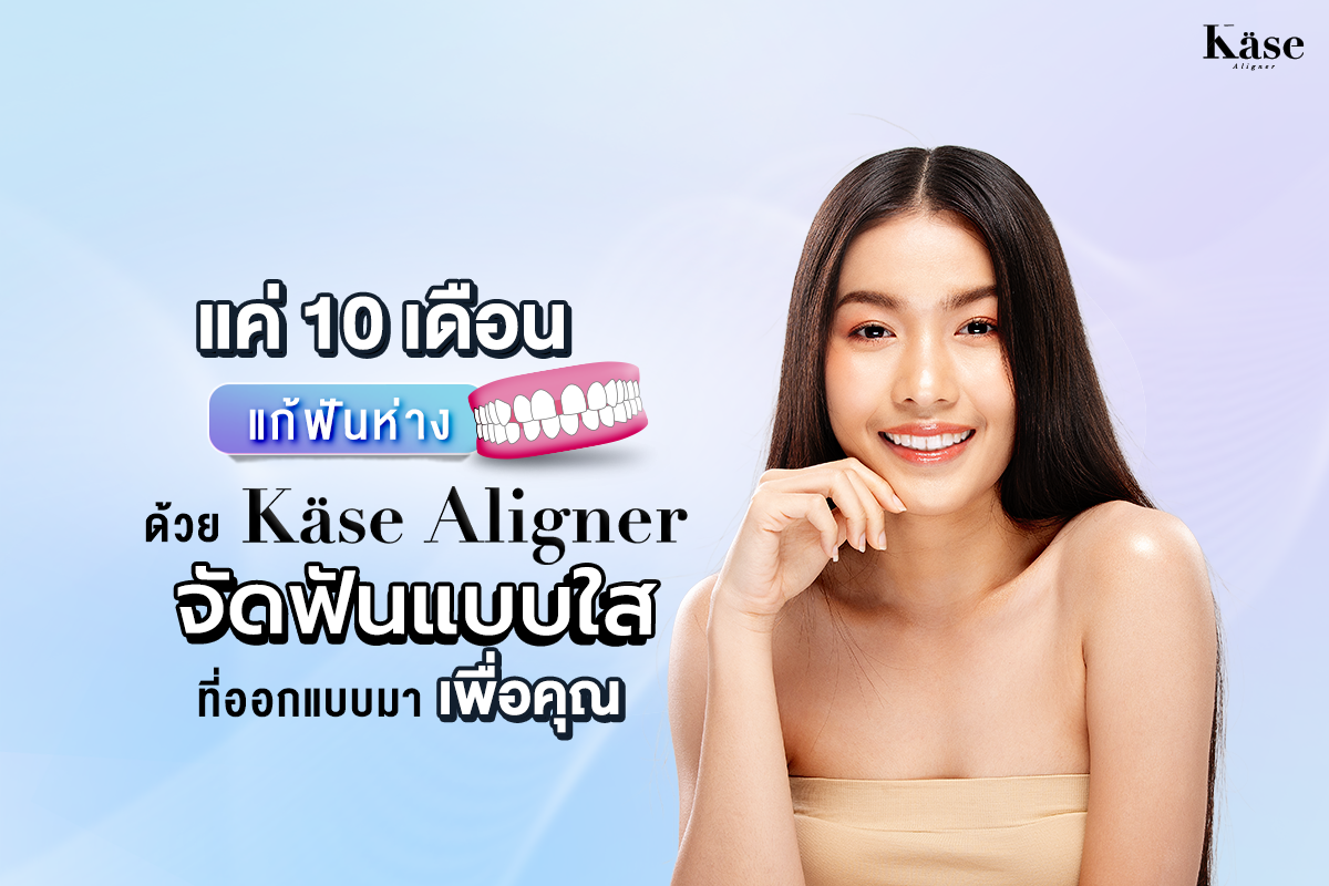 จัดฟันแบบใส Käse Aligner