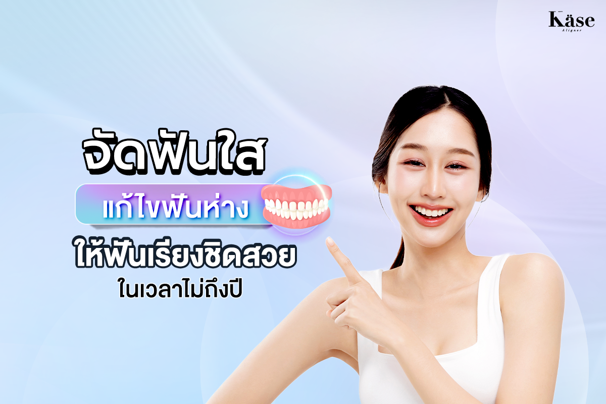 จัดฟันใสแก้ไขฟันห่าง