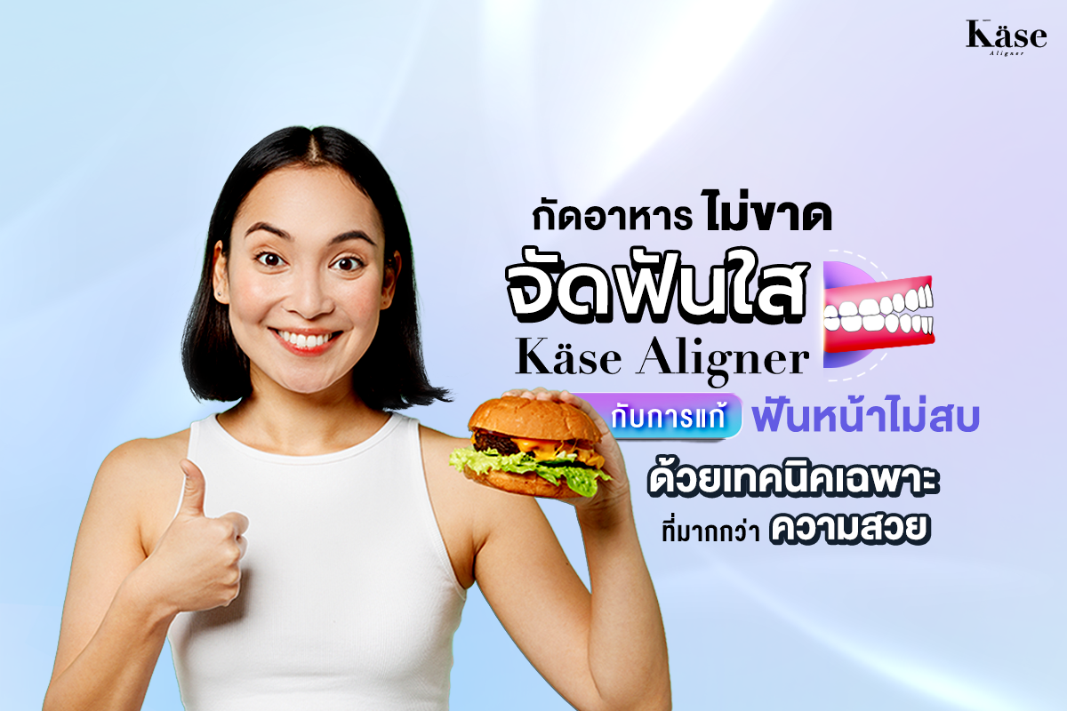จัดฟันใส Käse Aligner