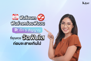ฟันซ้อนเก